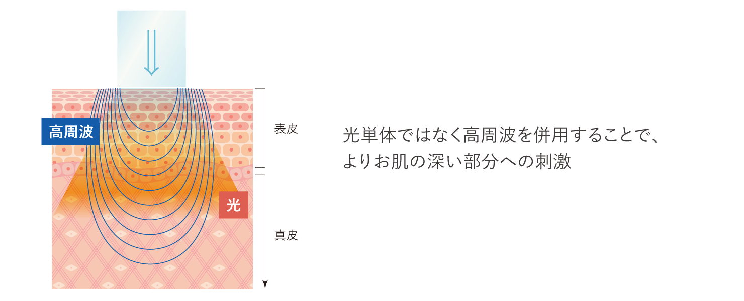 フォトRFのイメージ
