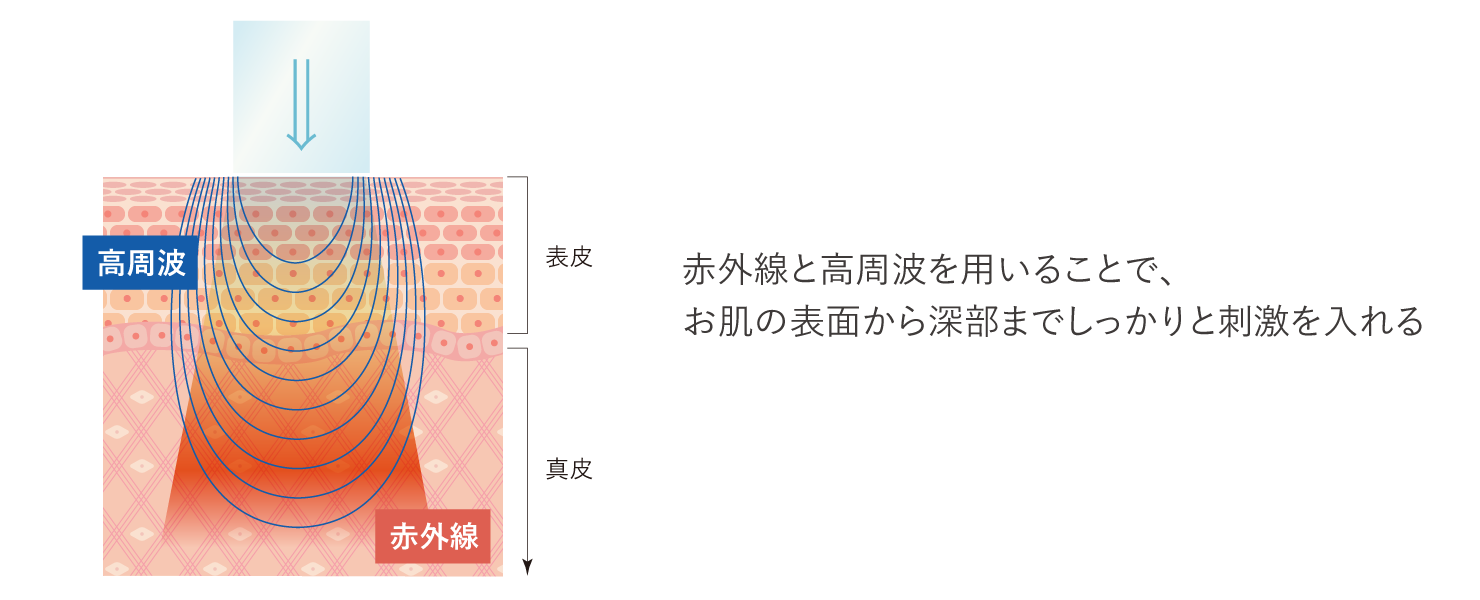 リファームSTのイメージ