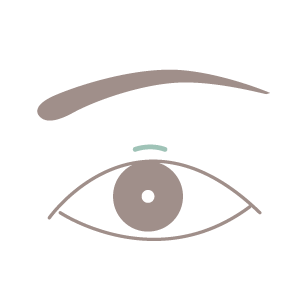 小切開法手術