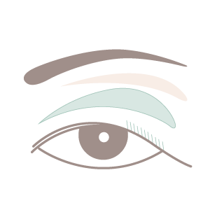 全切開法手術